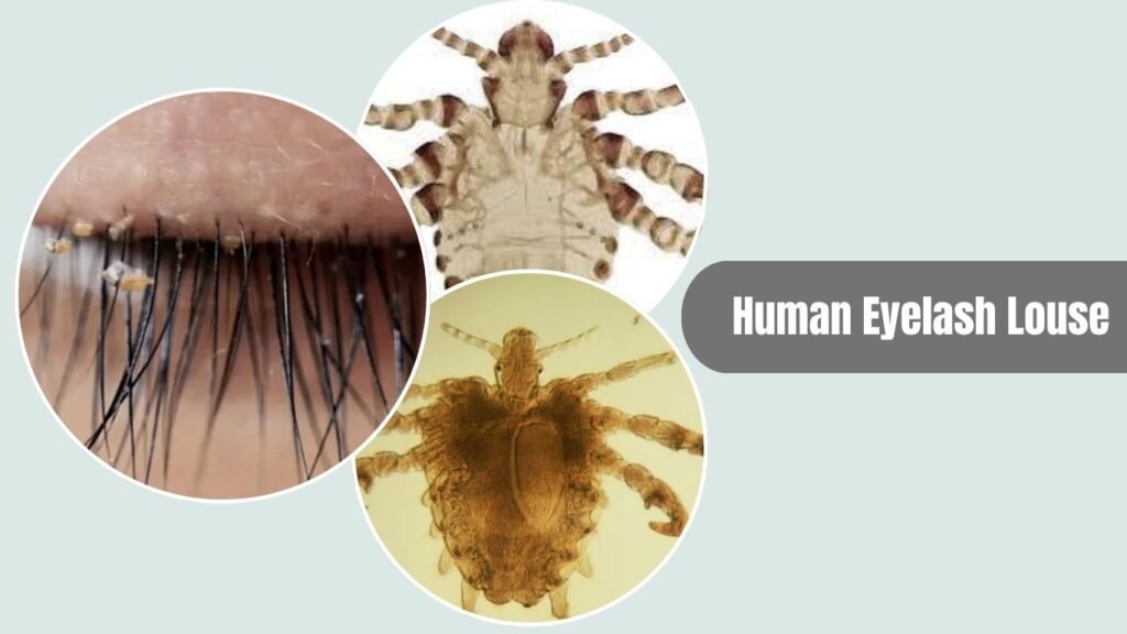 17 Types of Lice: Species That Affect Humans, Animals & Birds