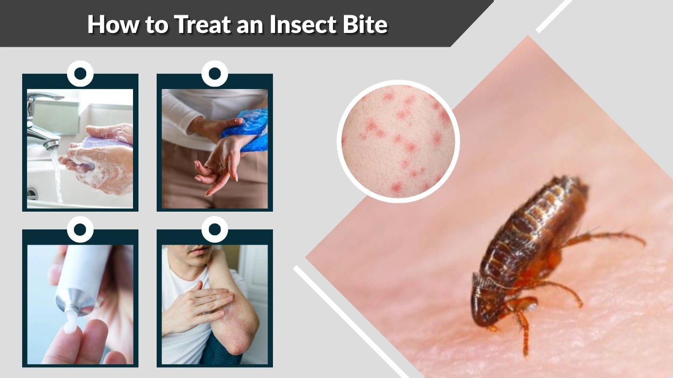 How to Treat an Insect Bite: Swelling, Blisters, Pus, and More