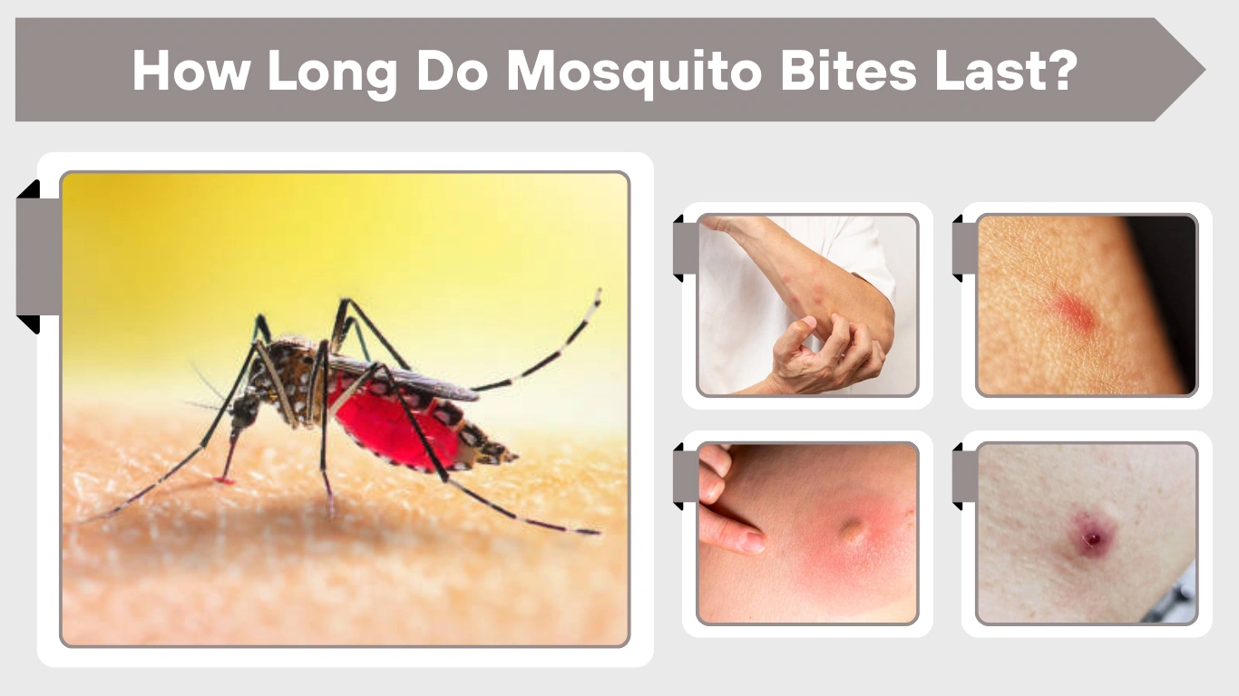 How Long Do Mosquito Bites Last Healing, Itching & Marks