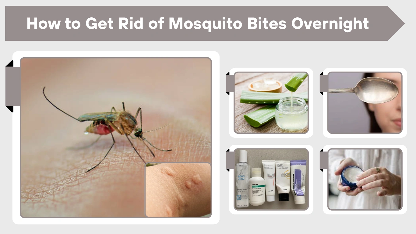 How to Get Rid of Mosquito Bites Overnight Fast & Naturally