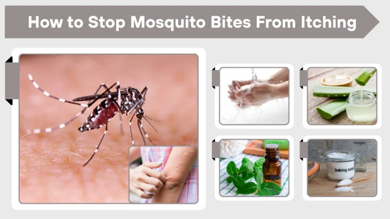 How to Stop Mosquito Bites From Itching Fast & Naturally How to Stop Mosquito Bites From Itching Fast & Naturally