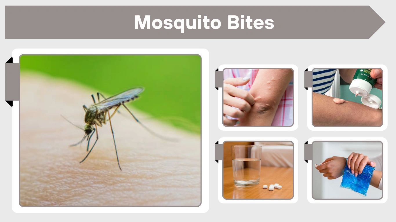 Mosquito Bites: Causes, Symptoms, Treatment & Prevention