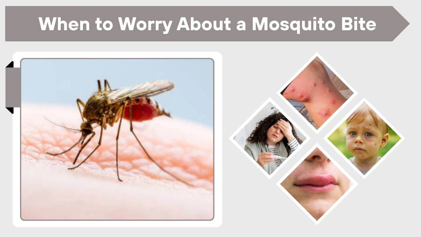 When to Worry About a Mosquito Bite: Signs You Shouldn’t Ignore