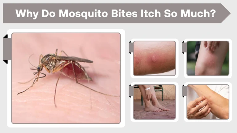 Why Do Mosquito Bites Itch So Much? Full Breakdown & Fixes Why Do Mosquito Bites Itch So Much Full Breakdown & Fixes