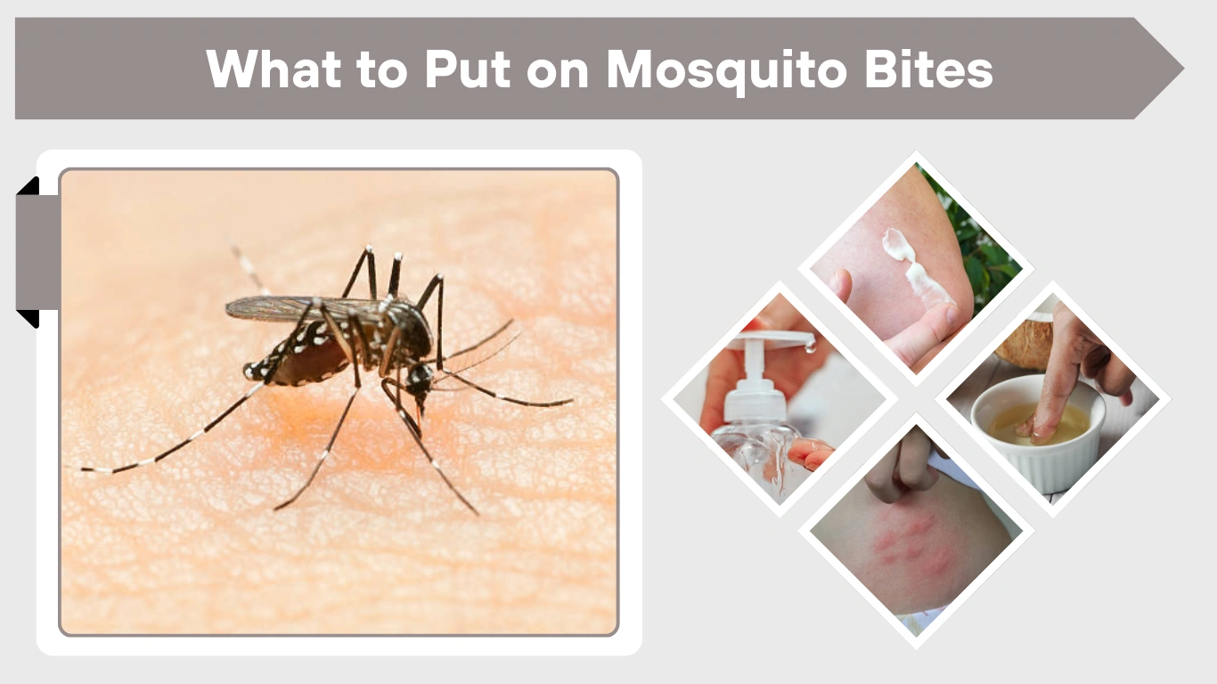 What to Put on Mosquito Bites: Best Treatments for Itching & Swelling