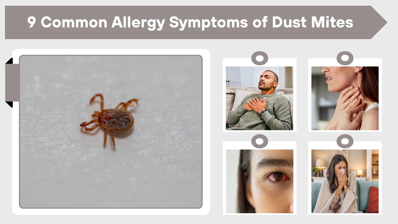 9 Common Allergy Symptoms of Dust Mites: You Should Know