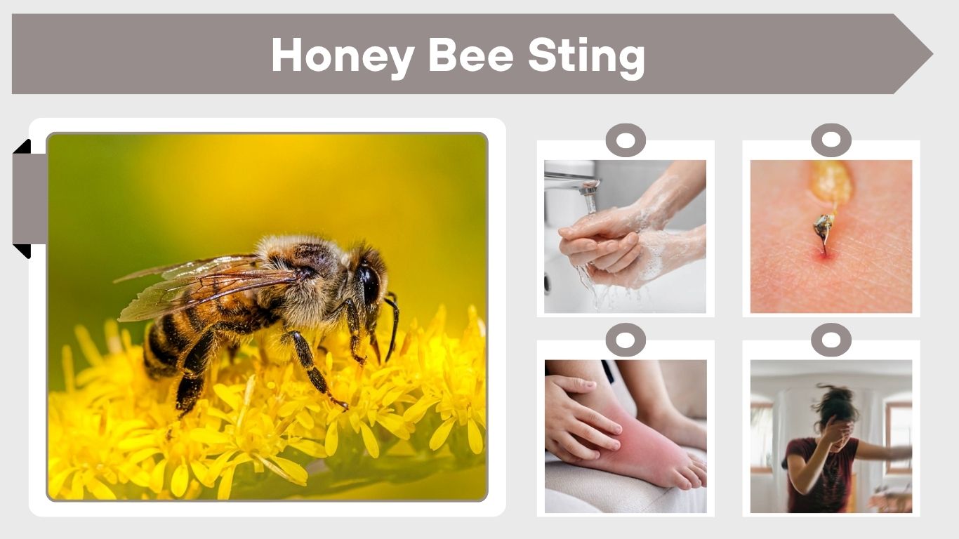 Honey Bee Sting: Symptoms, Treatment, and Safety Guide