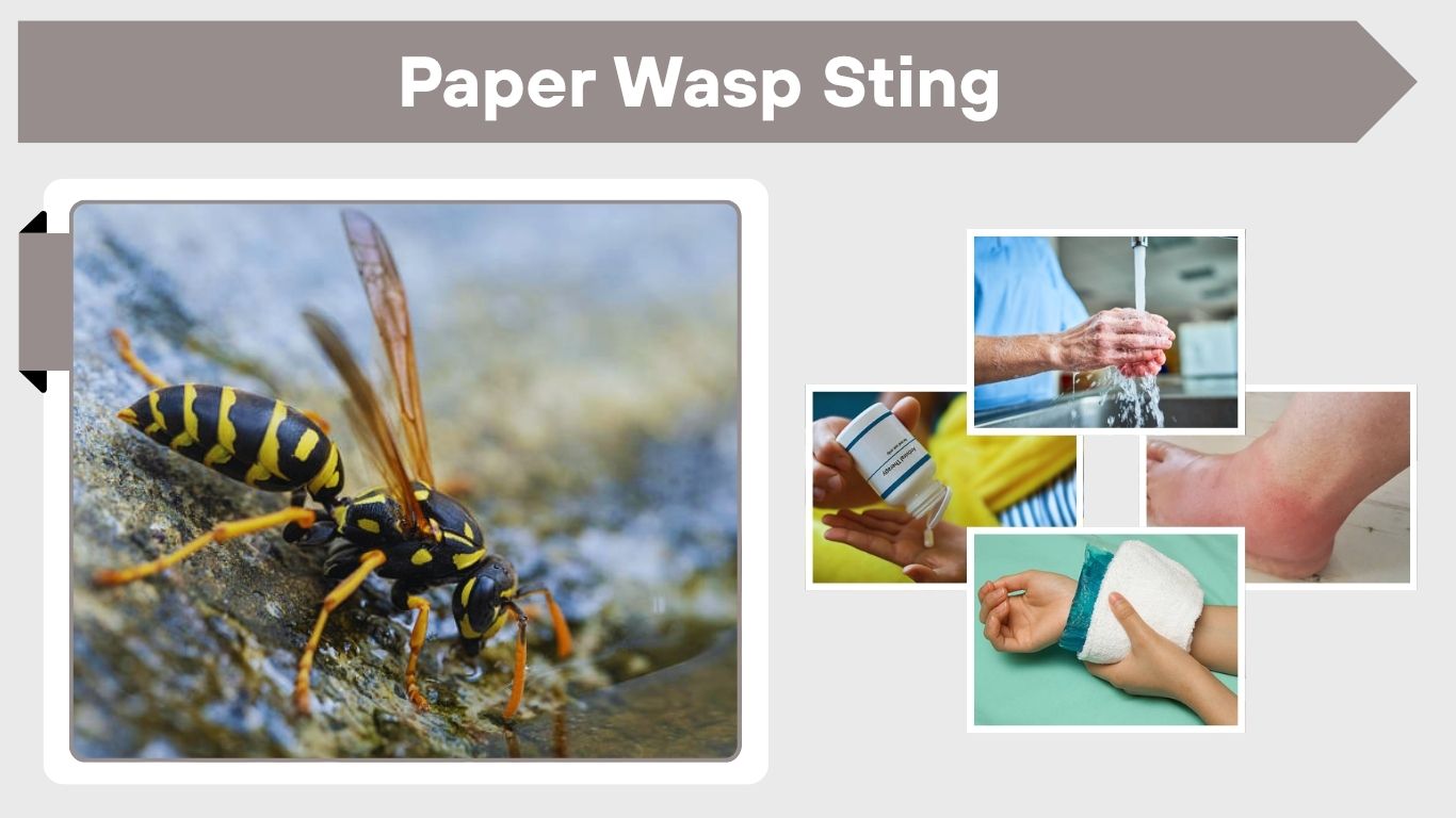 Paper Wasp Sting: Pain, Symptoms and Treatment