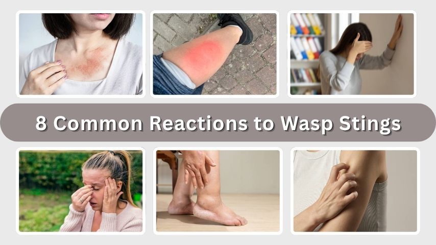 8 Common Reactions to Wasp Stings: Symptoms & Treatment Tips