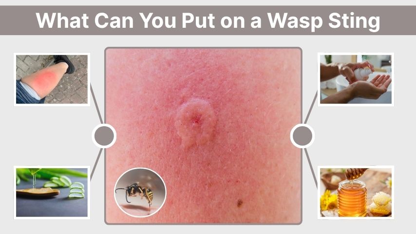 What Can You Put on a Wasp Sting for Fast Relief?