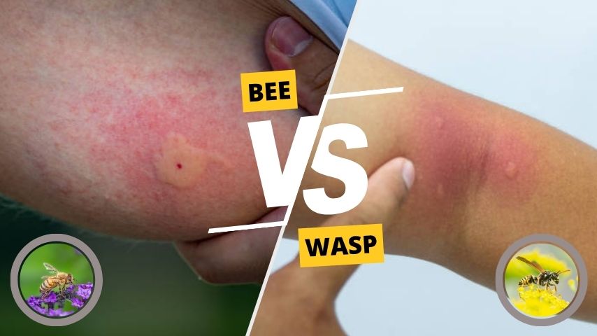 Bee Sting and Wasp Sting Symptoms and Treatment