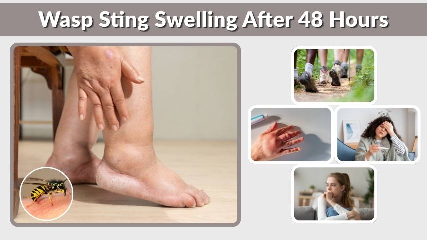 Wasp Sting Swelling After 48 Hours: Is It Normal?
