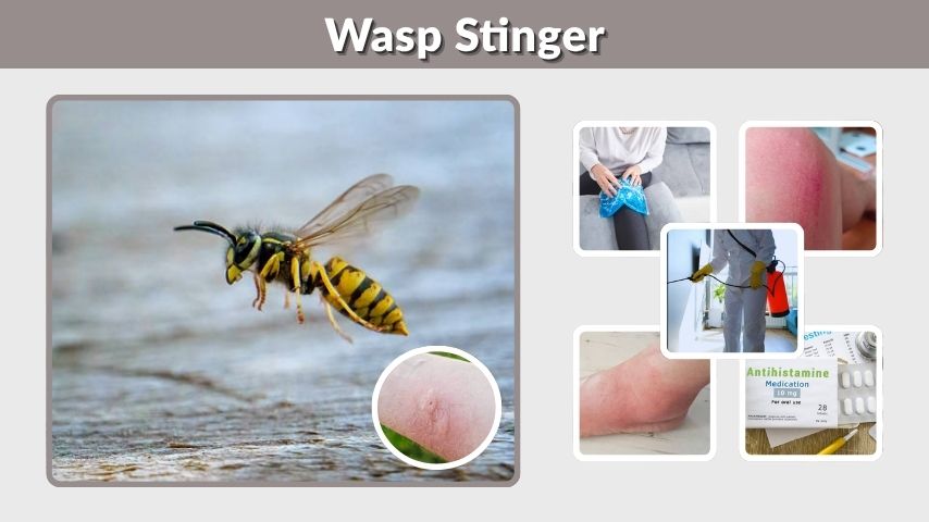Wasp Stinger: What Should You Do Immediately?