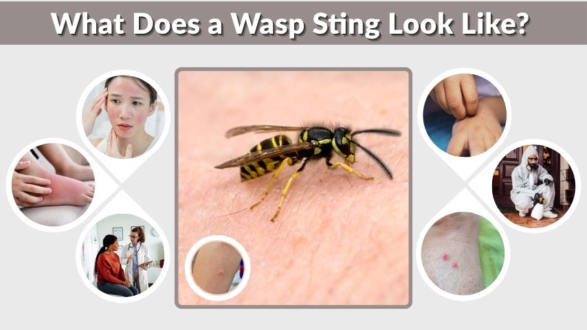 What Does a Wasp Sting Look Like? Identification with Pictures