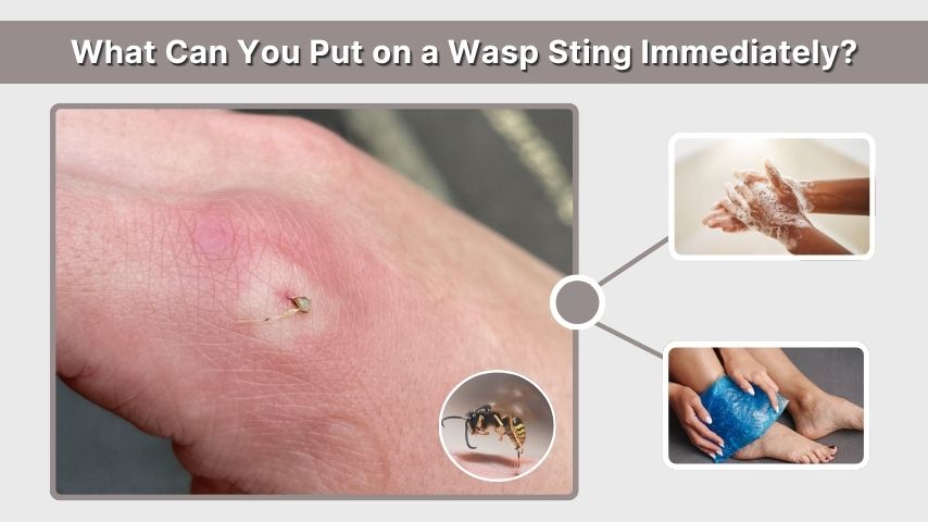 What Can You Put on a Wasp Sting Immediately?