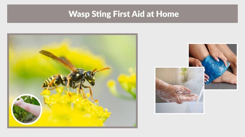 Wasp Sting First Aid at Home