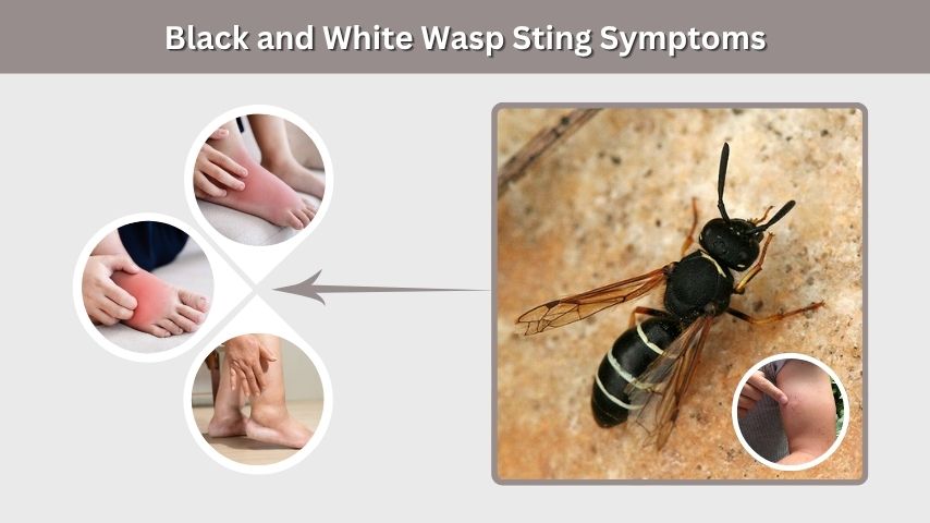 Black and White Wasp Sting Symptoms