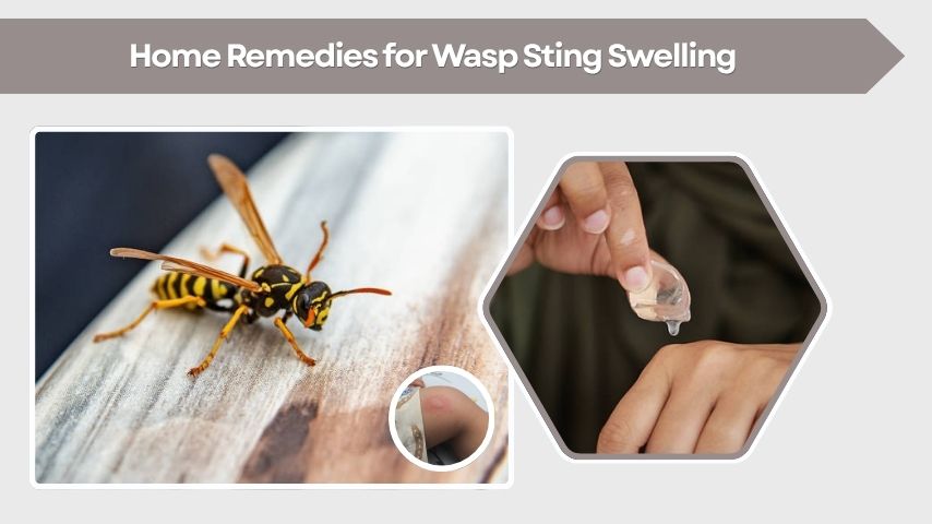 Home Remedies for Wasp Sting Swelling