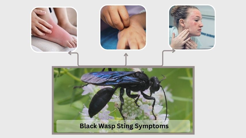 Black Wasp Sting Symptoms