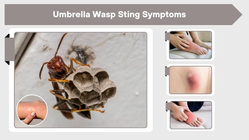 Umbrella Wasp Sting Symptoms