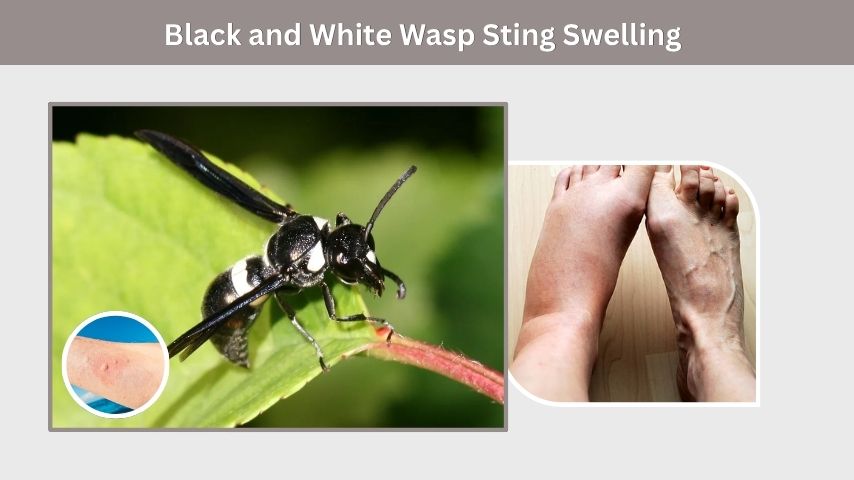 Black and White Wasp Sting Swelling
