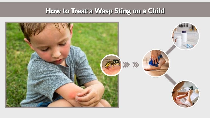 How to Treat a Wasp Sting on a Child