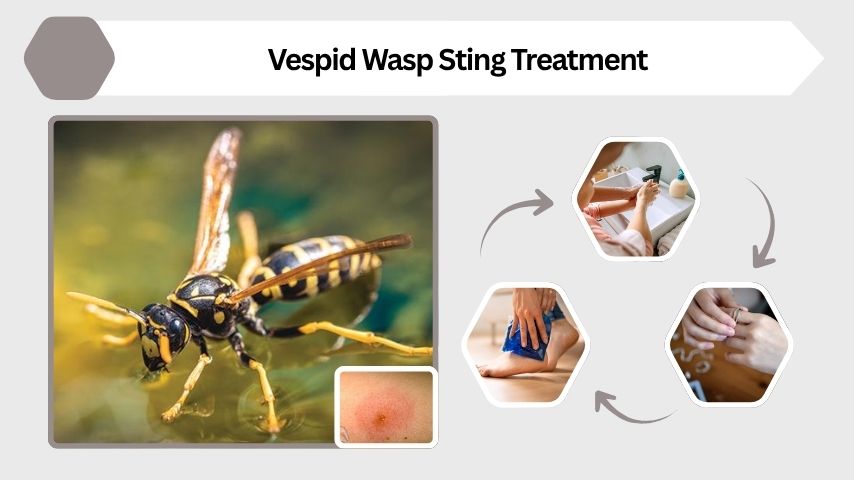 Vespid Wasp Sting Treatment