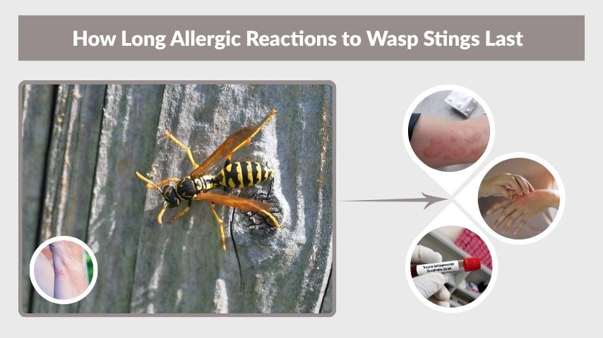 How Long Allergic Reactions to Wasp Stings Last