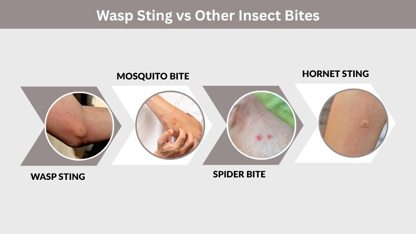 Wasp Sting vs Other Insect Bites