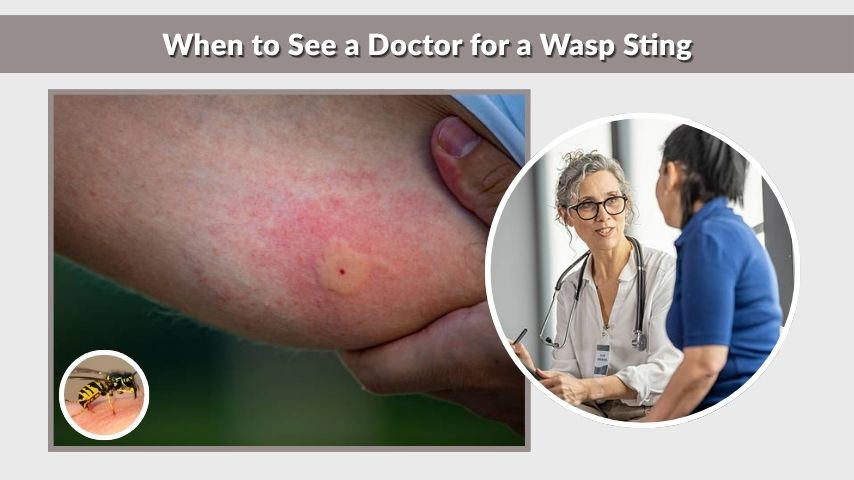 When to See a Doctor for a Wasp Sting