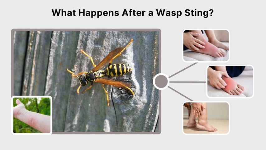 What Happens After a Wasp Sting?