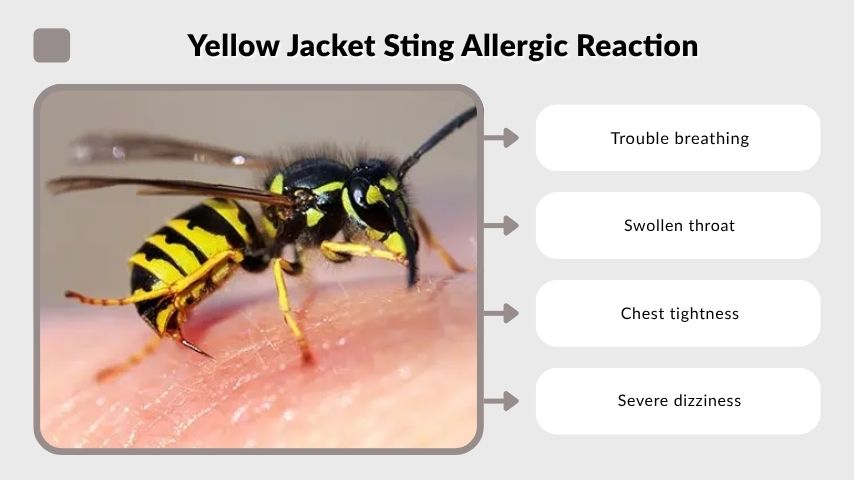 Yellow Jacket Sting Allergic Reaction