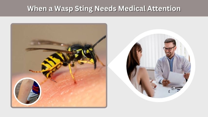 When a Wasp Sting Needs Medical Attention