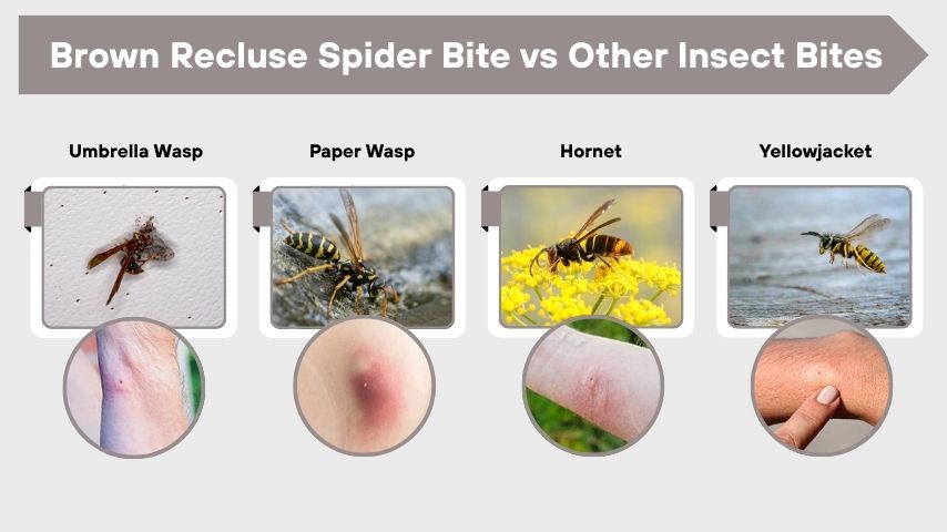 Umbrella Wasp Sting vs Other Wasp Stings