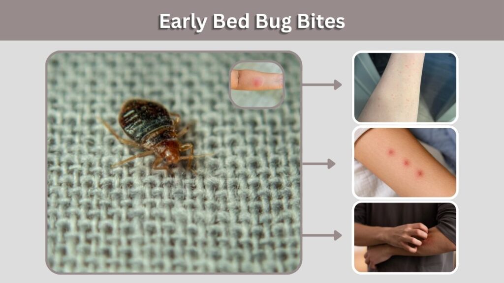 Early Bed Bug Bites