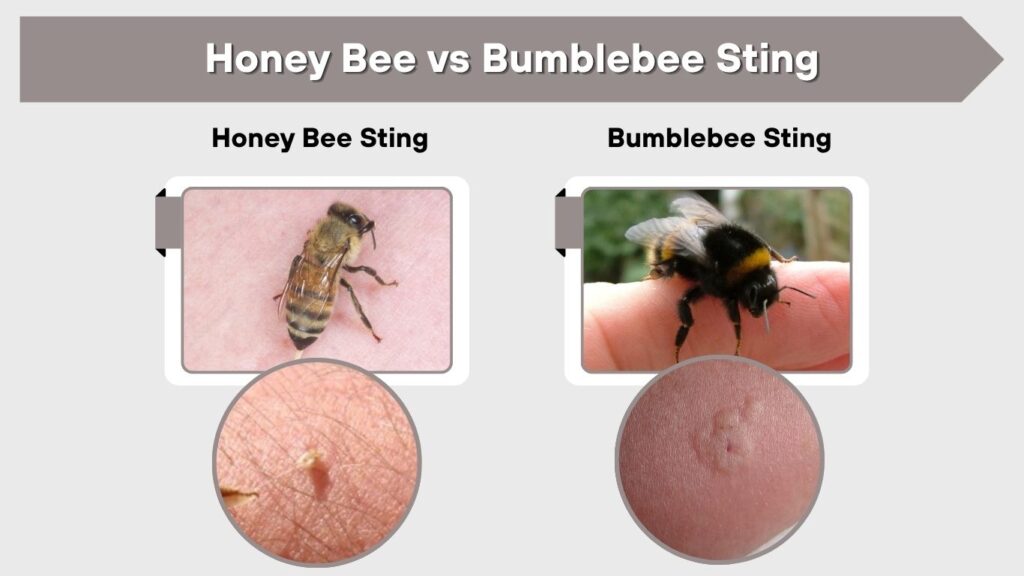 Honey Bee vs Bumblebee Sting