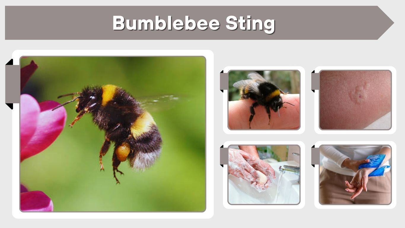 Bumblebee Sting: Symptoms, Treatment & Pain Guide