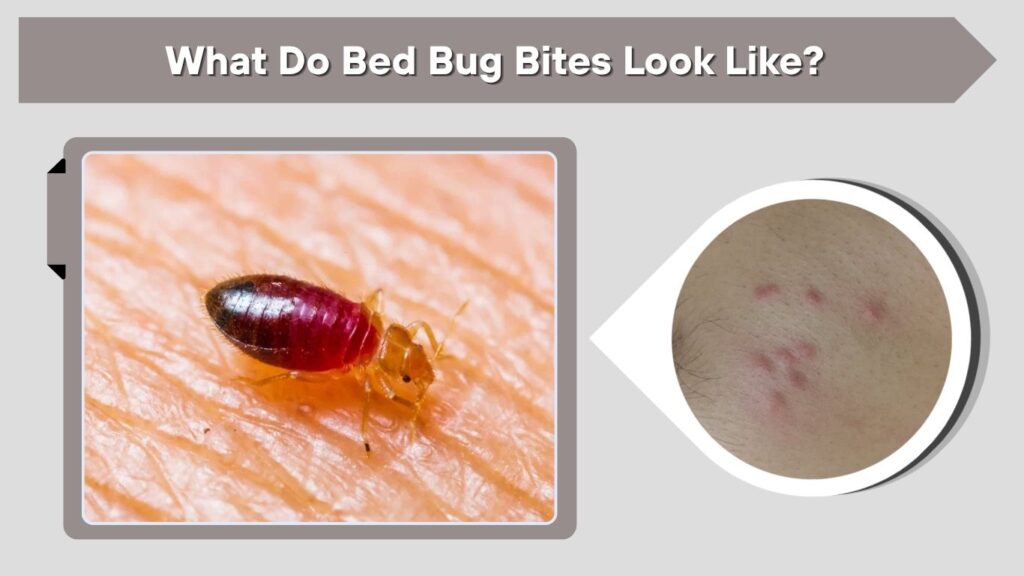 What Do Bed Bug Bites Look Like?