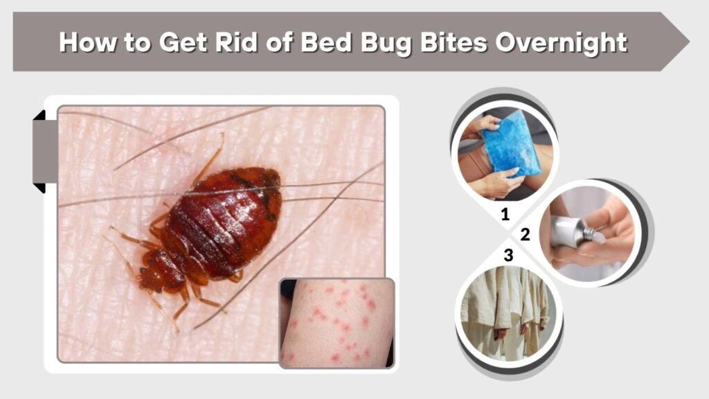 How to Get Rid of Bed Bug Bites Overnight