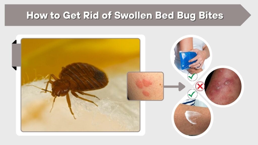 How to Get Rid of Swollen Bed Bug Bites
