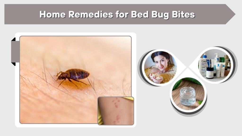 Home Remedies for Bed Bug Bites