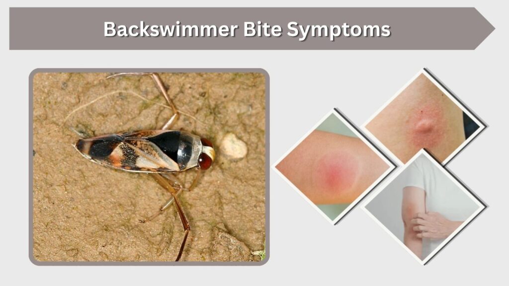 Backswimmer Bite Symptoms