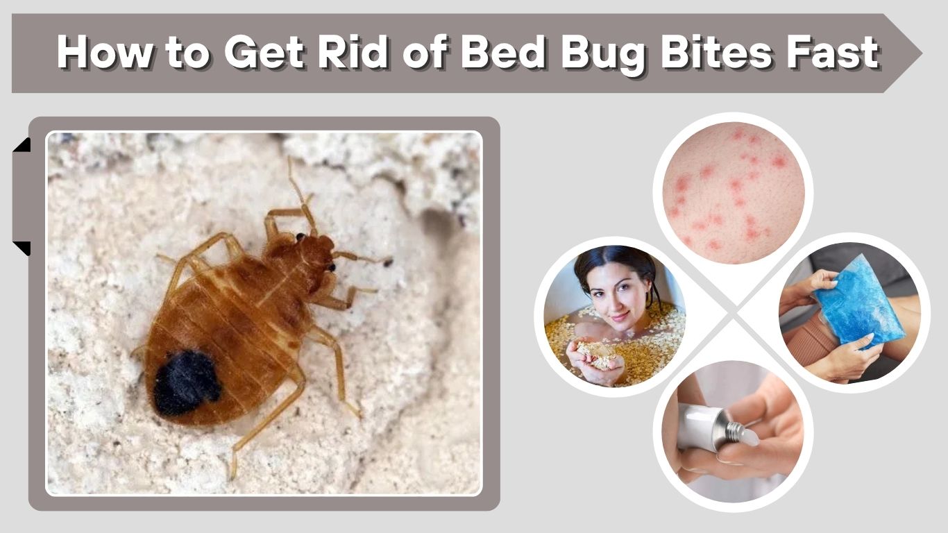 How to Get Rid of Bed Bug Bites Fast