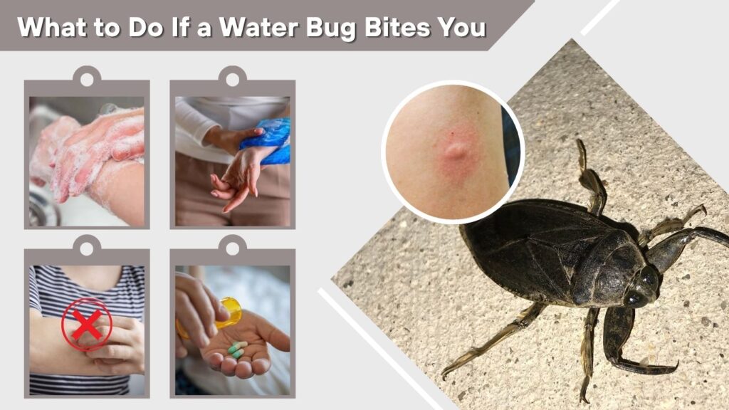 What to Do If a Water Bug Bites You