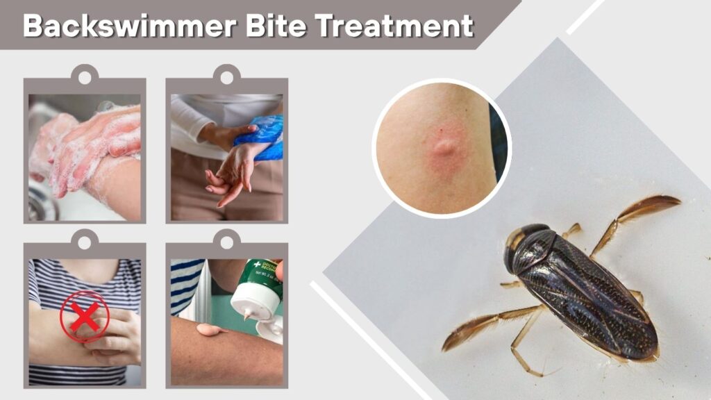 Backswimmer Bite Treatment
