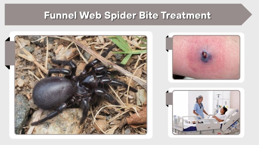 Funnel Web Spider Bite Treatment