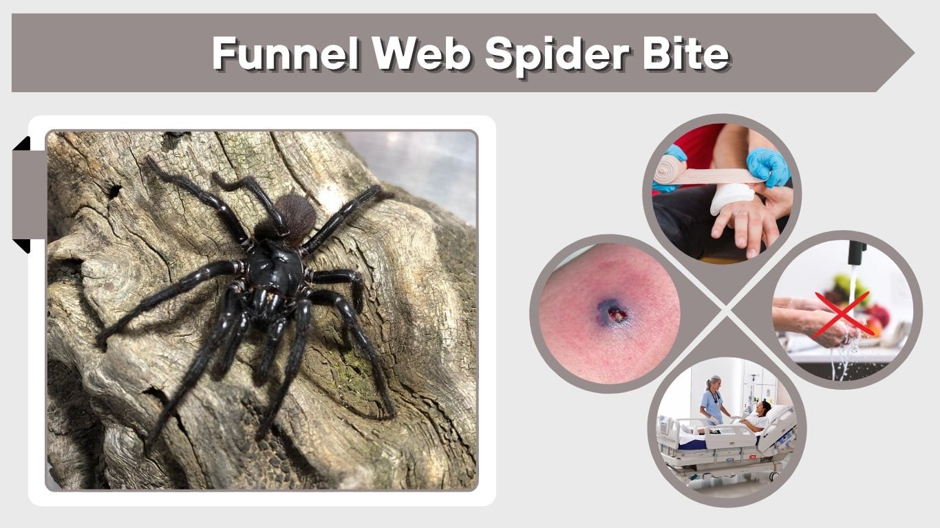 Funnel Web Spider Bite: Symptoms, First Aid, and Treatment