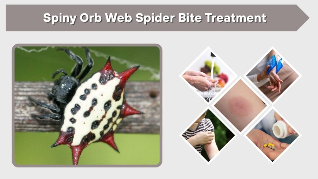 Spiny Orb Web Spider Bite Treatment