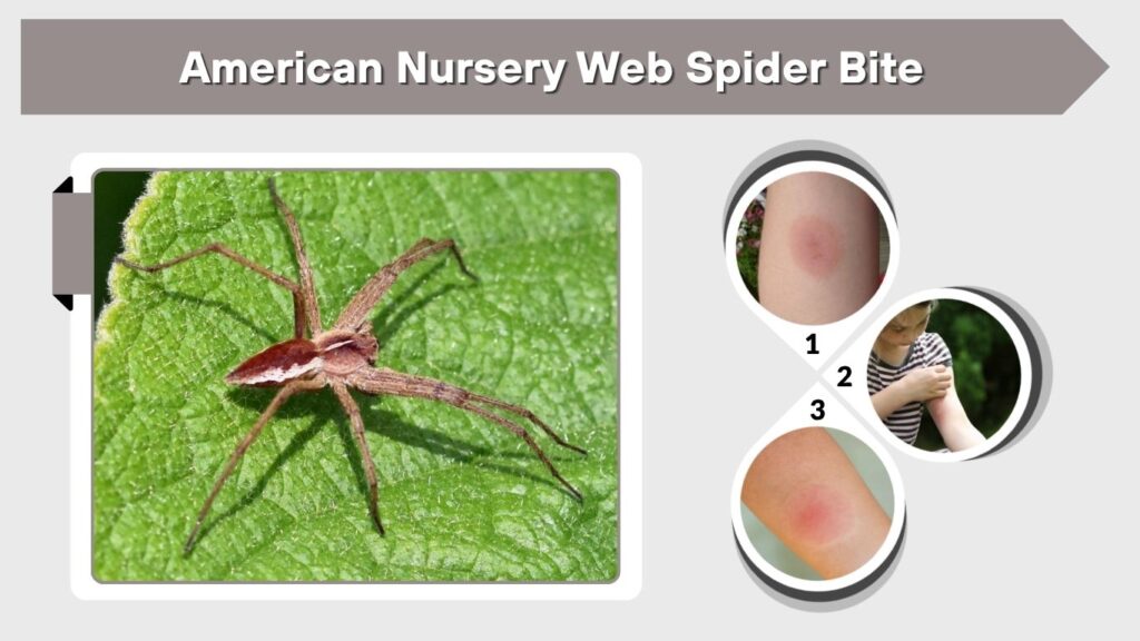 American Nursery Web Spider Bite