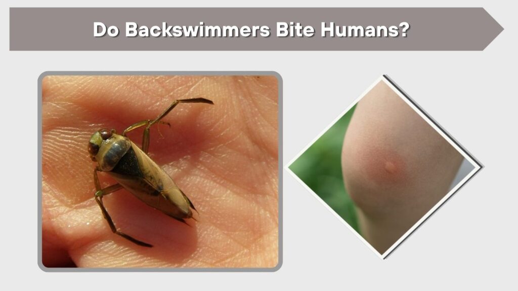 Do Backswimmers Bite Humans?